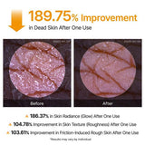「PEEL SHOT」Face + Body Dual System